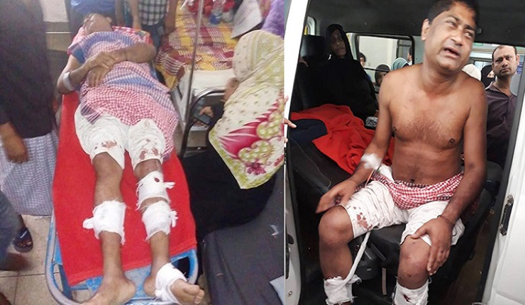 প্রেস ক্লাব সাধারণ সম্পাদকের পা ভেঙে দিলেন আওয়ামী লীগ নেতা