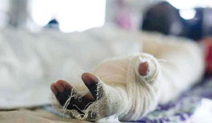 ফেনীতে পরীক্ষা কেন্দ্রে ছাত্রীর গায়ে পেট্রল ঢেলে আগুন