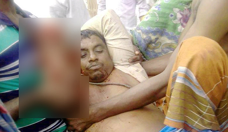 গুরুদাসপুরে আ’লীগ নেতার হাত কেটে নিয়েছে প্রতিপক্ষ!