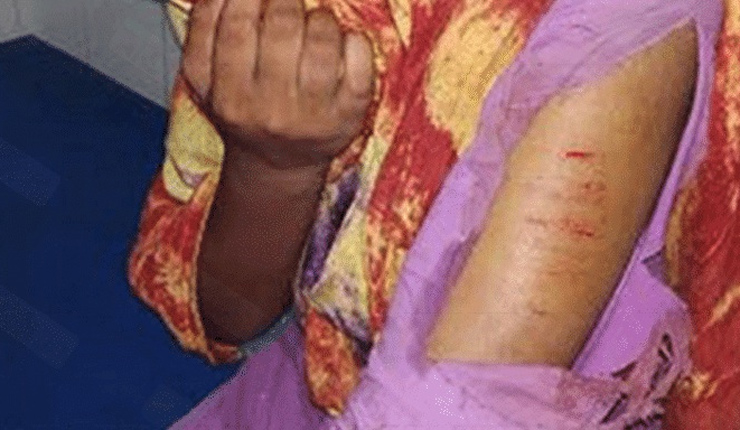 ধর্ষণের চেষ্টায় ব্যর্থ হয়ে স্কুলছাত্রীকে ছুরিকাঘাত