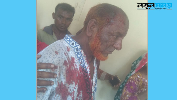 পীরগঞ্জে যুদ্ধাহত মুক্তিযোদ্ধার উপর সন্ত্রাসী হামলা