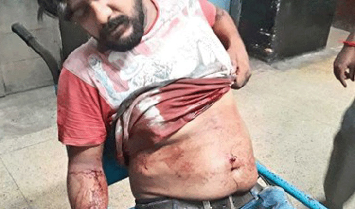 মায়ের হাতে রিভলবার! গুলিতে গুরুতর ​আহত ছেলে