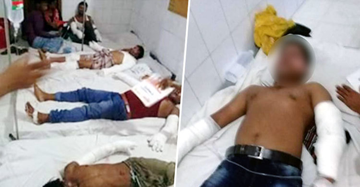 প্রবাসীকে বিদায় জানিয়ে ফেরার পথে ২০ জন দগ্ধ