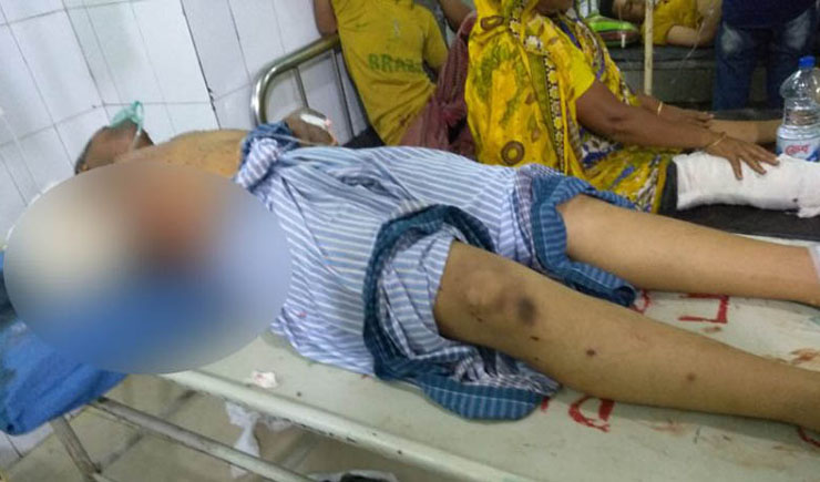 নারায়ণগঞ্জে গ্যাস লাইন বিস্ফোরণে নিহত ১, দগ্ধ ৭