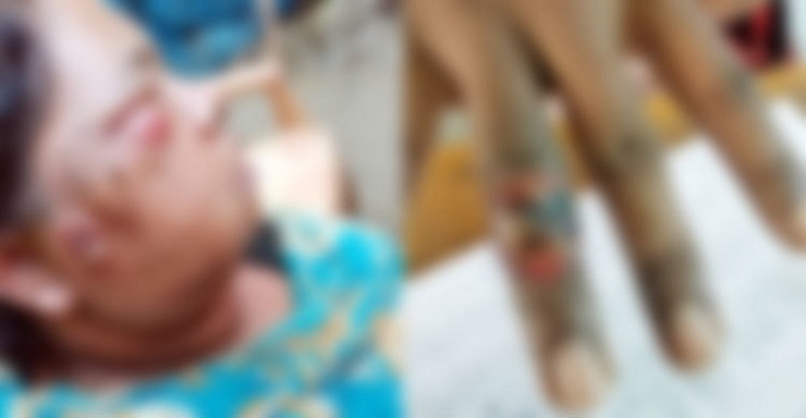 মেহেরপুরে অ্যানথ্রাক্স রোগের প্রাদুর্ভাব