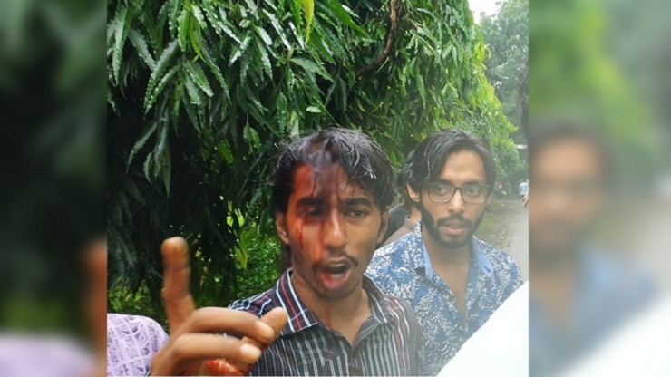 আহত জাবি ছাত্রলীগ কর্মী সাব্বির হোসেন নাহিদ। 