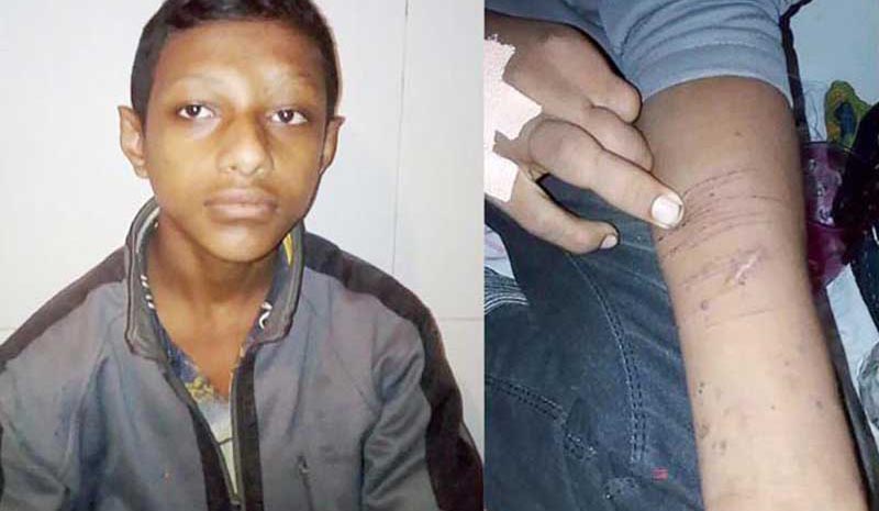 'চুরির অপবাদ' দিয়ে স্কুলছাত্রকে গাছে বেঁধে নির্যাতন