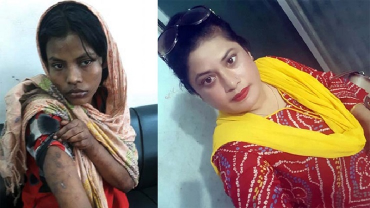 গরম খুন্তির ছ্যাঁকায় কালো দাগ পড়ে গেছে ডালিয়ার শরীরে