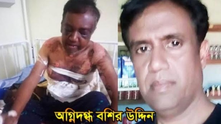 আফ্রিকান সন্ত্রাসীর আগুনে দগ্ধ বাংলাদেশির দেশে ফেরার আকুতি