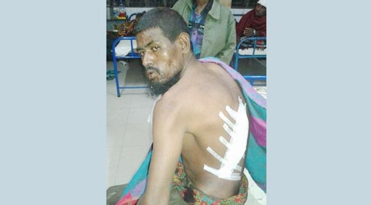 ভিক্ষা চাওয়ায় মানসিক প্রতিবন্ধিকে ছুরিকাঘাত