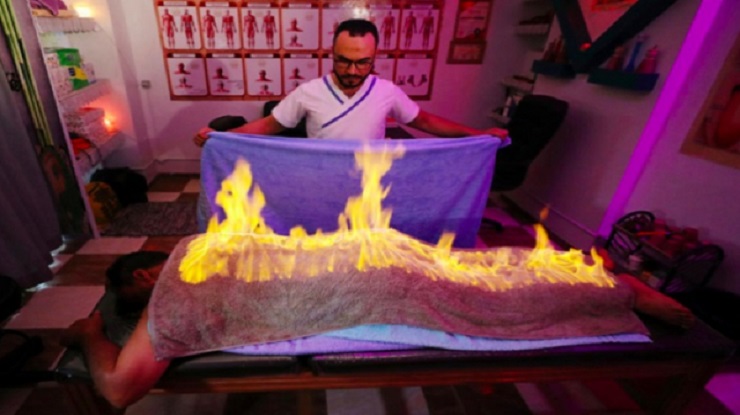 ব্যথা কমাতে আগুন জ্বালানো হচ্ছে রোগীর শরীরে