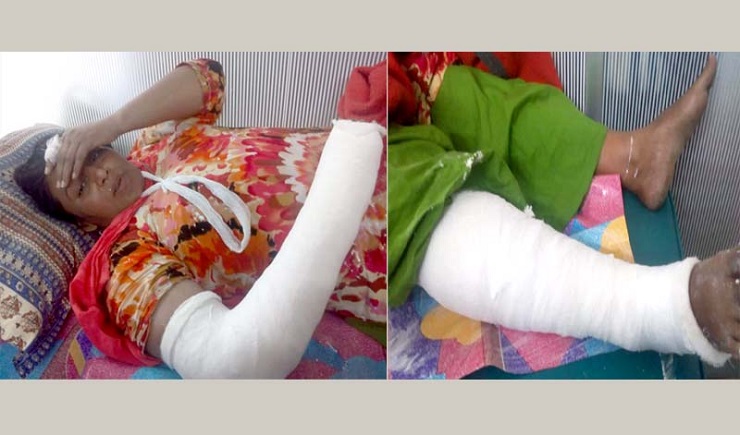 আশুলিয়ায় নারীকে রড দিয়ে পিটিয়ে হাত-পা ভাঙ্গলো যুবলীগ নেতা