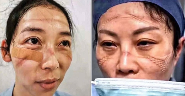 চীনের ডাক্তার-নার্সদের মুখের দিকে তাকানো যাচ্ছে না