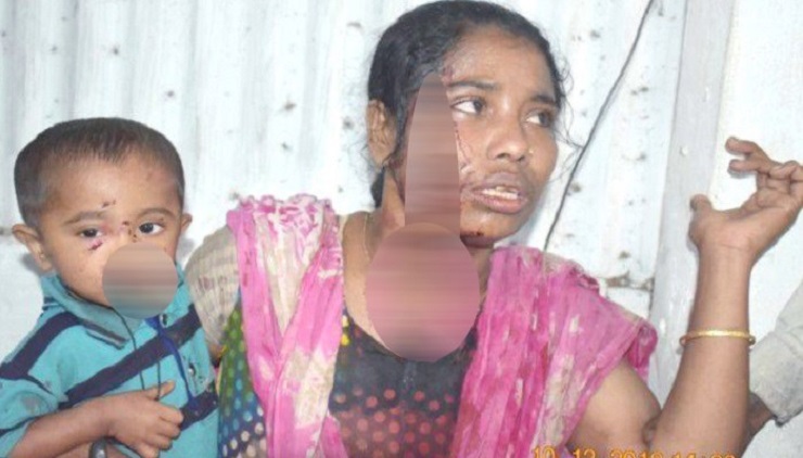 পানি দিতে দেরি হওয়ায় ভাবি-ভাতিজাকে পিটিয়ে রক্তাক্ত