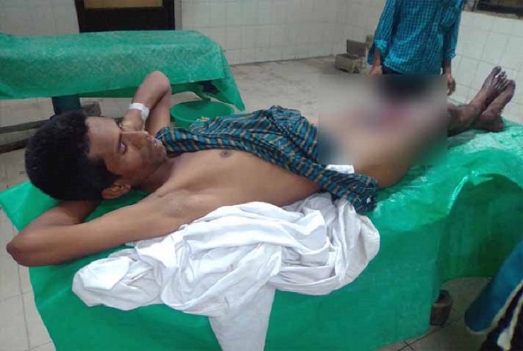 বউয়ের সাথে ঝগড়া করে নিজের লিঙ্গ কেটে ফেলল যুবক