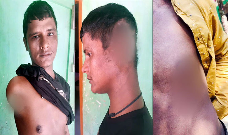 হাত ও কান  কেটে নিল আপনজন,বছর পরে শোনালেন লোমহর্ষক কাহিনি