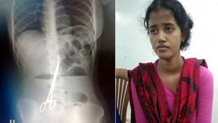৩ ঘণ্টার চেষ্টায় বের হলো দেড় বছর পেটে থাকা সেই ‘কাঁচি’