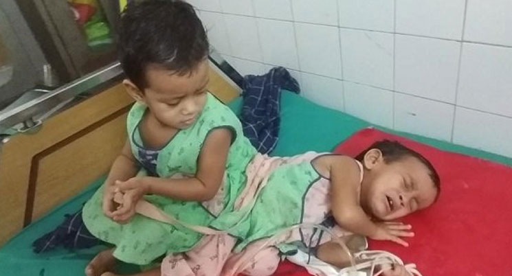 আগামীকাল ঢামেকে আলাদা হবে জোড়া শিশু লাবিবা ও লামিসা