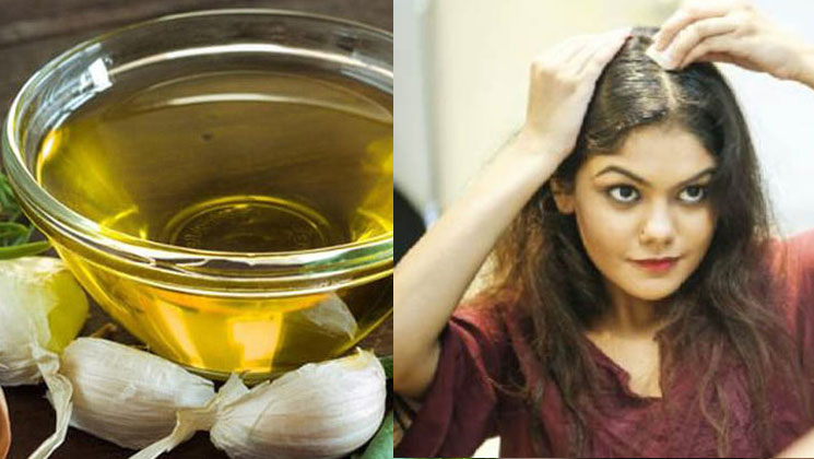খুশকি দূর করবে রসুনের ৩ প্যাক