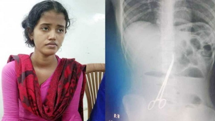 পেটে কাচি রেখে সেলাই করা চিকিৎসকদের খুঁজে পায়নি তদন্ত কমিটি!