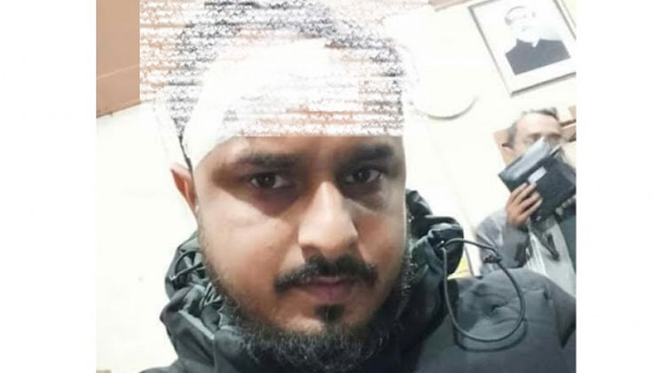 চলন্ত ট্রেনে দুর্বৃত্তের ঢিল, মাথা ফাটল চালকের