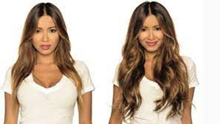 হারানো চুল পুনরুদ্ধার করেছে মাত্র তিন মাসে