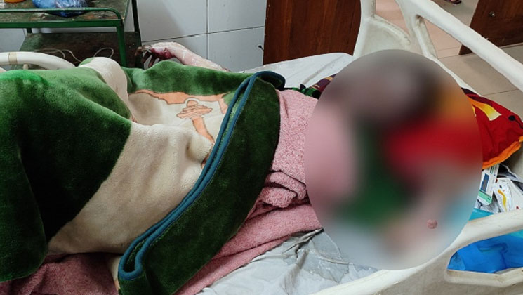মাঝরাতে দাহ্য পদার্থ দিয়ে ঝলসে দেওয়া হলো গার্মেন্টস কর্মীকে