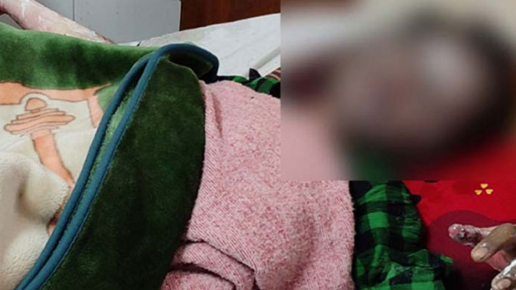 বিচ্ছেদের পর বিয়ের প্রস্তাব, রাজি না হওয়ায় এসিড নিক্ষেপ 