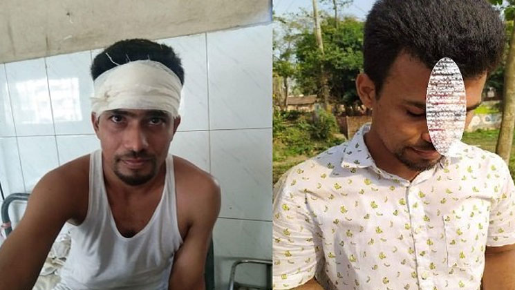 সুনামগঞ্জের ছাতকে বখাটেদের হাতে প্রভাষক আহত