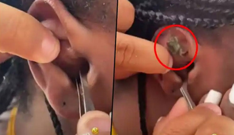 নারীর কান থেকে বের হলো জীবন্ত কাঁকড়া!