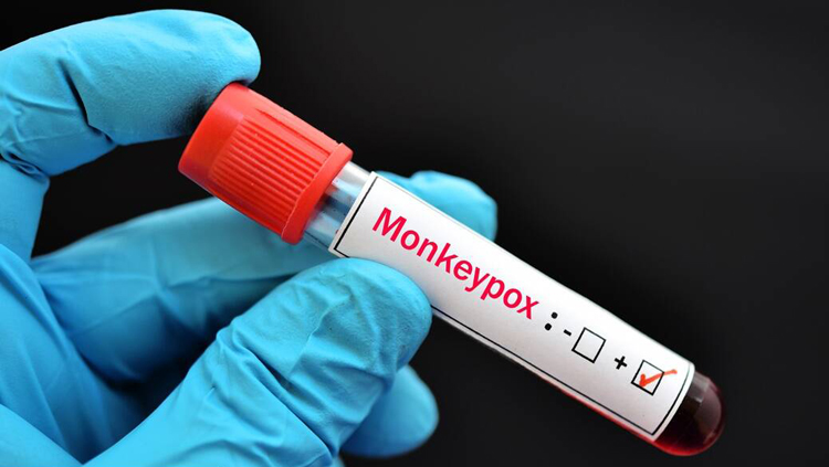 মাঙ্কিপক্সের নতুন নাম আহ্বান, দিতে পারেন আপনিও
