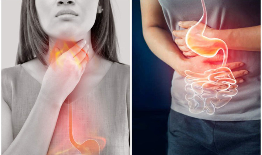 গলা-বুক জ্বালাপোড়া করে কেন? কী সমাধান