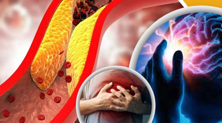  কোলেস্টেরল সম্পর্কে যা কিছু জানা জরুরি