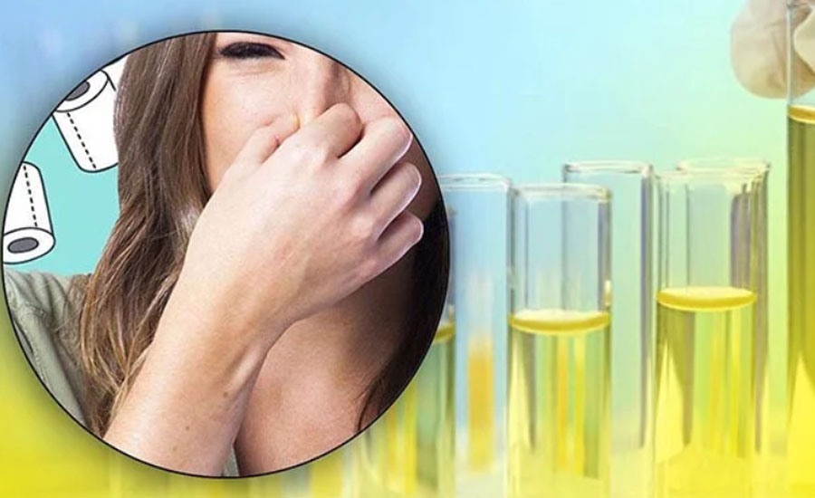 প্রস্রাবে মাত্রাতিরিক্ত দুর্গন্ধ যেসব রোগের লক্ষণ