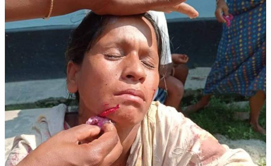 নীলফামারীতে শিয়ালের কামড়ে একই পরিবারের শিশু সহ ৬ জন আহত