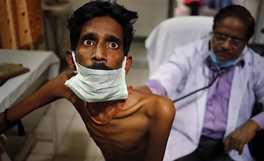 দেশে এইডস রোগী শনাক্তে রেকর্ড