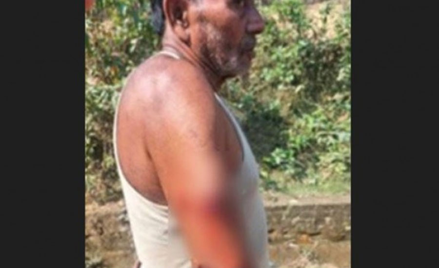 মিয়ানমারের ছোড়া গুলিতে বাংলাদেশী আহত