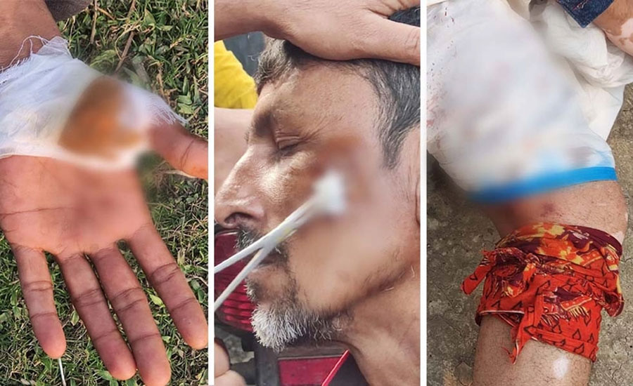 আবারও রফিক বাহিনীর তাণ্ডবে রক্তাক্ত নাওড়া